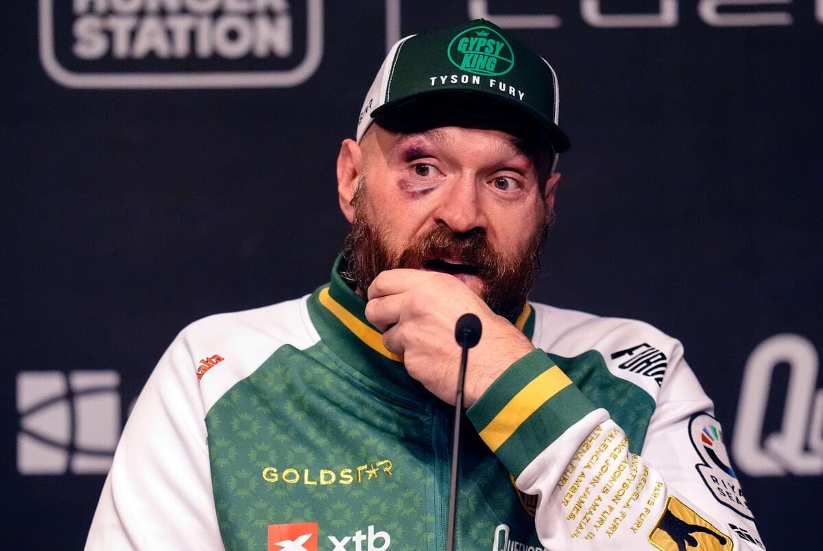 Tyson Fury